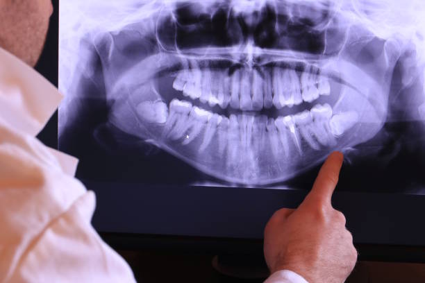 Best Emergency Dental Services for Seniors in Belle Meade, TN